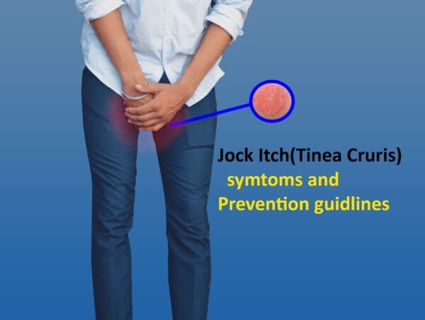 What does Jock Itch(Tinea cruris) look and Smell like, How It Is Treated?