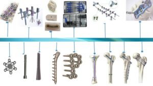 orthopedic medical devices 5