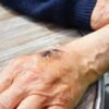 <strong>How to Tell If You Have an Infected Cut and What to Do About It</strong> 5 hand g6863778c5 1920