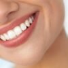 All You Must Know About Composite Bonding 5 bonding