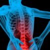 How that Annoying Back Pain Can Go Away With The Help of Physical Therapy 3 Back Pain