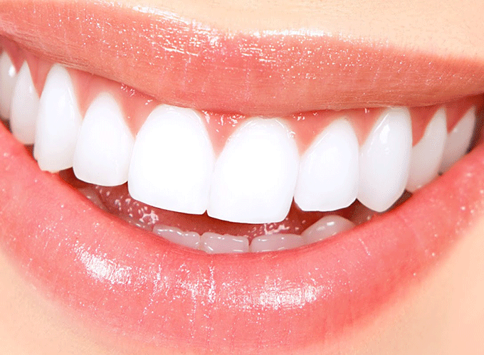 Dental